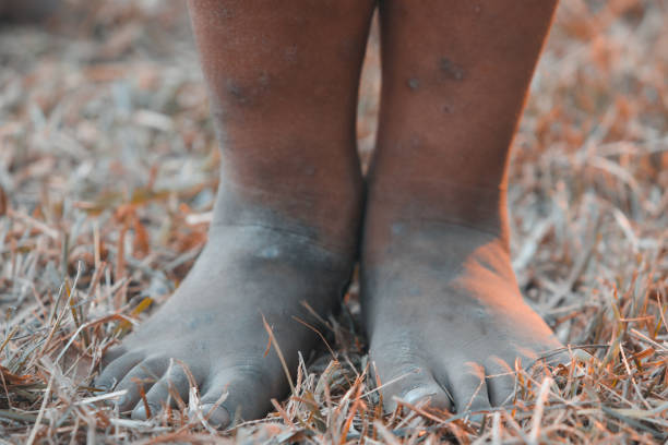 Miguu Ya Mtoto Wangu Ilikuwa Hainyooki Baada Ya Kuanza Kutembea Lakini Sayansi Haingetatua Ila Hii Njia Ilisaidia