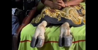 Drama Baada Ya Mwanamke Kupata Miguu Ya Mbuzi Baada Ya Kulala Na Bwana Ya Jirani Wake